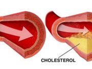 Těchto 12 potravin rozpustí a vyplaví usazený cholesterol z vašich cév