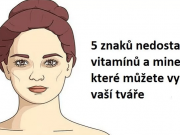 Když tělo volá o pomoc: Toto je 5 znaků nedostatku vitamínů a minerálů, které můžete vyčíst z vaší tváře
