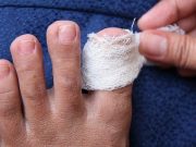 Trápí vás plíseň na nehtech? Zkuste tyto recepty našich babiček