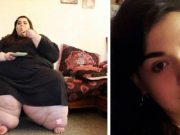 Nic není nemožné! Žena zhubla 200 kilogramů, nyní je z ní modelka!