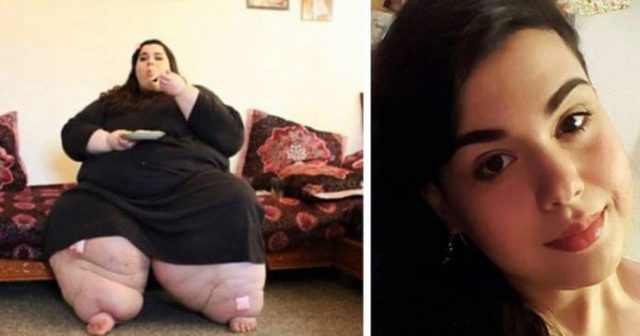 Žena zhubla 200 kilogramů, nyní je z ní modelka_1
